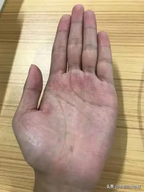 掌色暗沉发黑加上金星丘上青筋明显多半是血液循环不好的信号肠胃上也