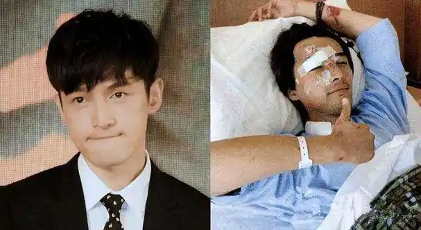 胡歌出车祸右眼被缝100多针黄磊看完声泪俱下袁弘推掉1年工作