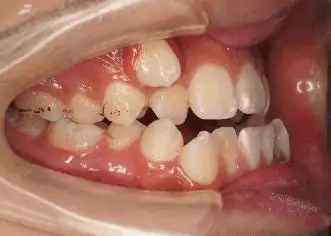 科普知识——虎年话虎牙