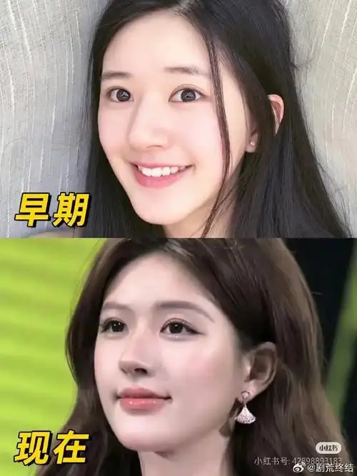 赵露思早期与现在的对比图,大家觉得这个变化明显吗?