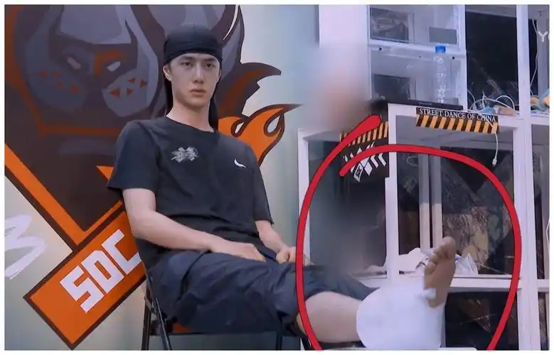 王一博《街舞》脚受伤缠绷带!独自坐在角落里,骨头水肿太心疼