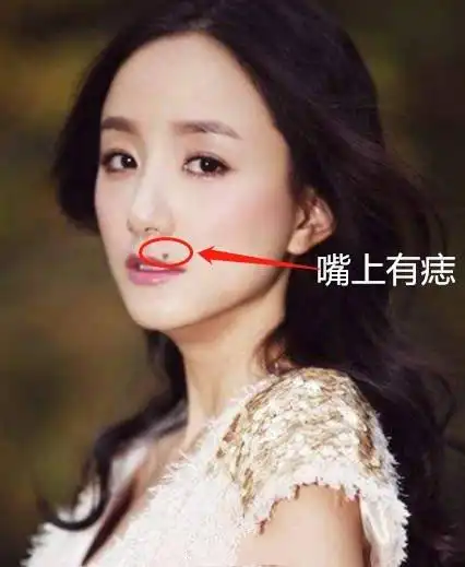 4,嘴上有痣 口舌是非不消停,是属于容易招小人的痣,往往会有许多的