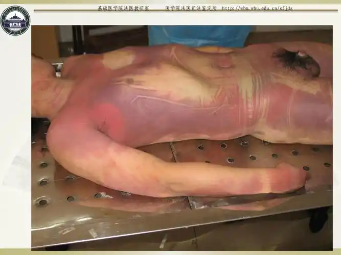 无忧文档 所有分类 自然科学 生物学 尸体变化ppt 基础医学院法医教研