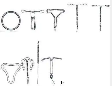 节育环的图片是什么样的