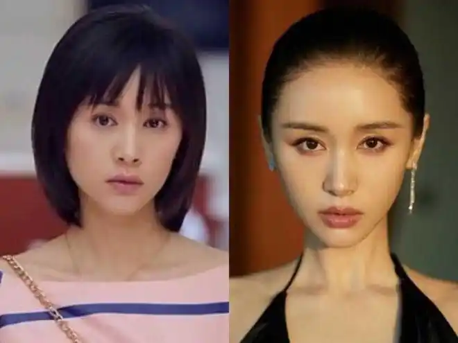 岁月不败美人,王子文面部填充的效果真的让人惊艳!_网易订阅