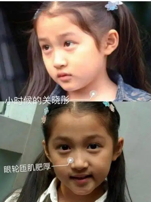 关晓彤作为97年的"_圈子-新氧美容整形