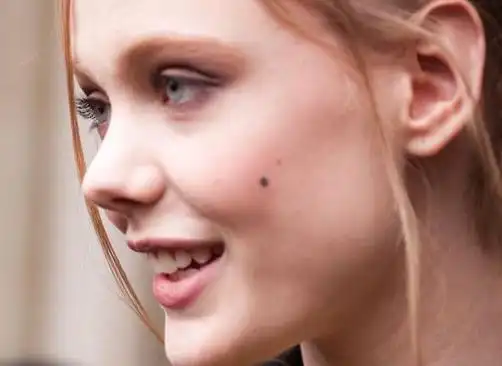 媒婆痣算美人痣吗不算啊