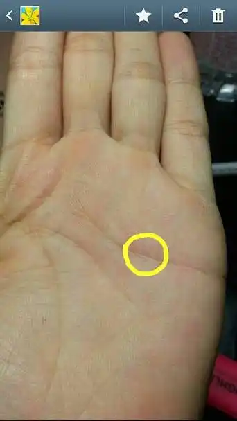 想知道我手掌上的这个是岛纹吗?