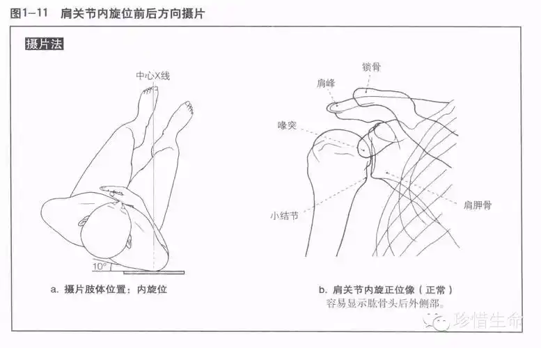 肩关节x线检查体位大全