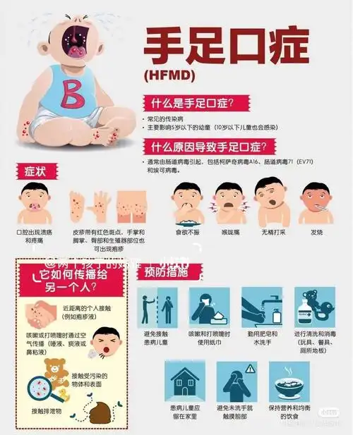 的妈咪提早先做好防范和如何应对的功课hfmd手足口症是一种病毒感染