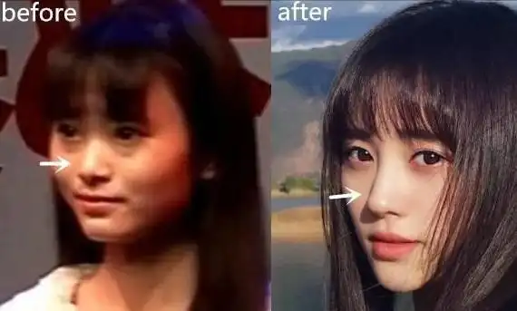 整容最成功的女明星是谁