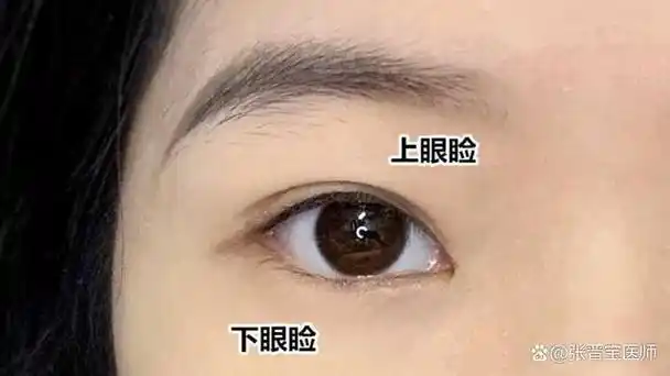 刚做完眼袋和双眼皮的那几天,心里就像经历了"过山车"