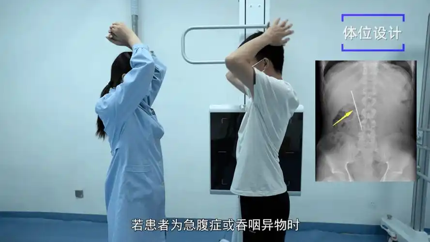 x线规范化检查腹部前后位摄影视频及图文详解