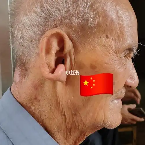 神奇的耳朵90,拥有这样耳朵的人是长寿之人哦