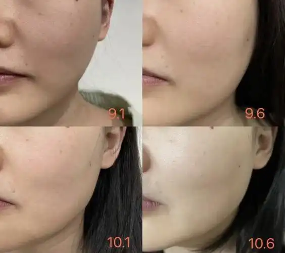 祝成功!|美白|抗衰|面膜|面霜|淡纹|红素_网易订阅