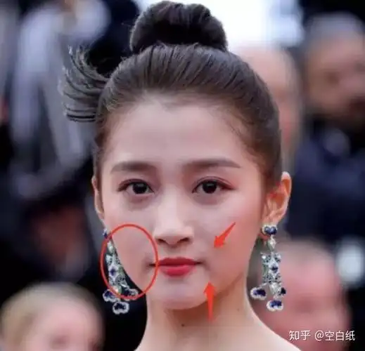 22岁关晓彤的脸到底怎么了对初老sayno