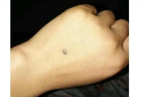 手背上长痣看出你的命运