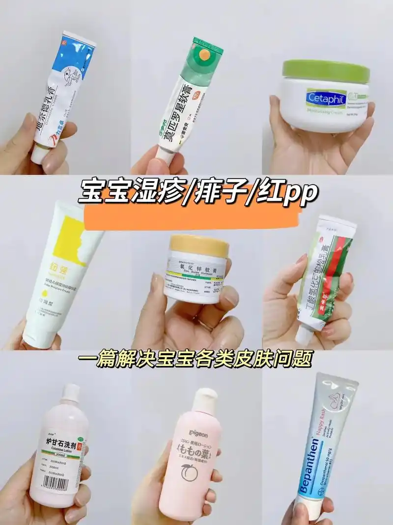 湿疹宝宝必备: ①地奈德乳膏:低激素,可用 - 抖音