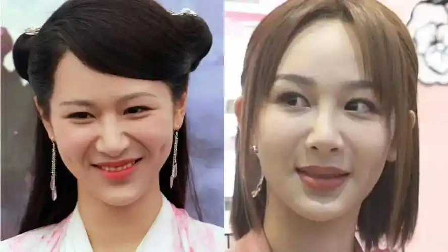 被苹果肌"毁"了的明星们,杨紫脸僵,毛晓彤脸肿,个个一言难尽_张萌