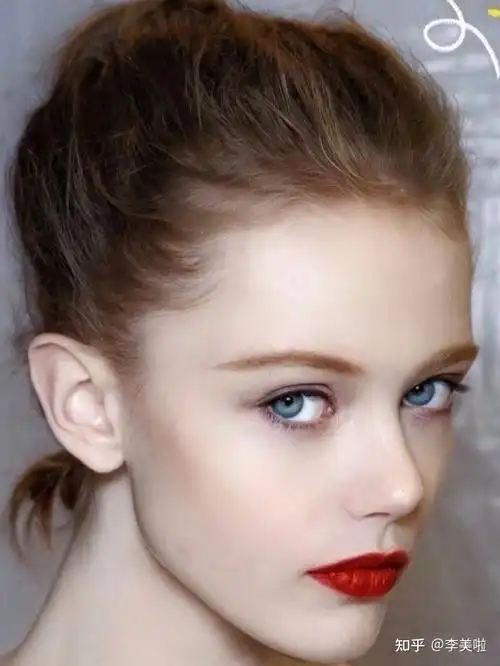 精灵耳的操作是比较简单的,一个通过注射玻尿酸对耳朵塑型,根据个人