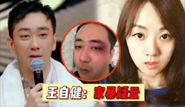 (往事不堪回首)2015年,王自健在说相声时,说老婆经常在家里打他,还
