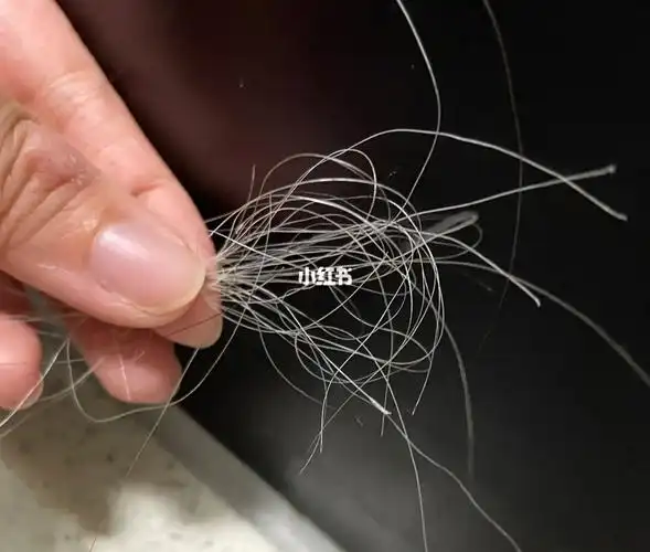 深夜拔半小时白头发的结果