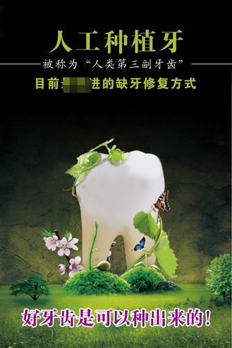763海报印制展板写真贴纸素材1715牙科诊所医院人工种植牙宣传图