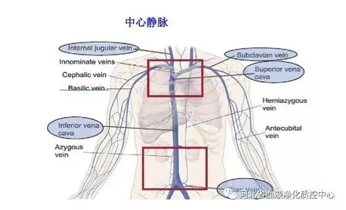 王玉柱教授通路相关性中心静脉病变