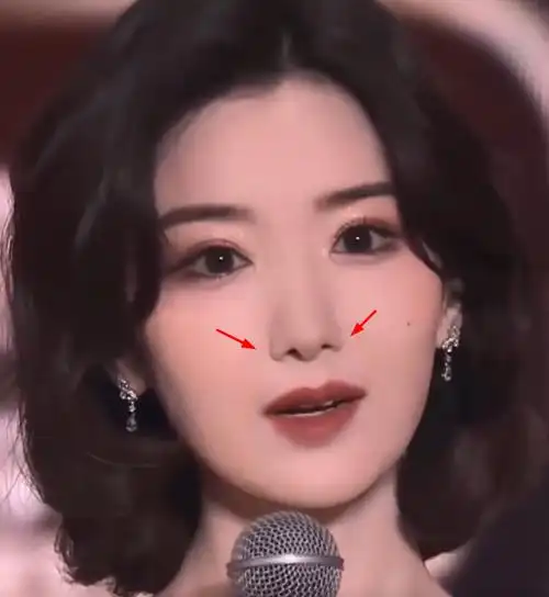 毛晓彤生图又变样,鼻子抢镜,今昔对比判若两人