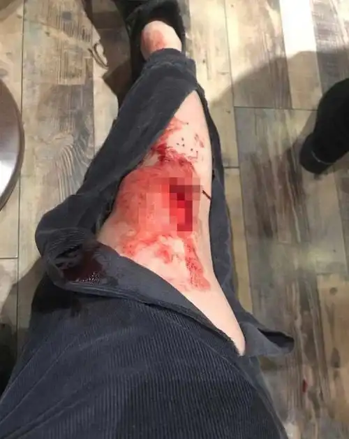 暴躁主播在线砍人,因游戏口角提刀砍伤同事