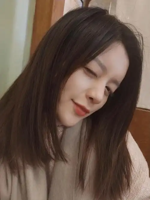 原生颜值80分,额头填充 鼻部多项后气质分!