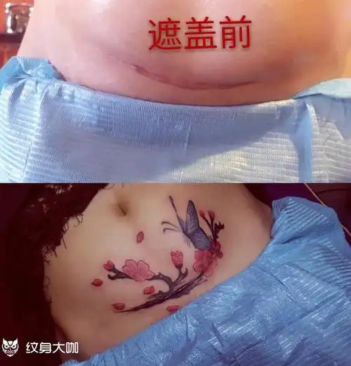 刨腹产遮盖_纹身图案手稿图片_嵩县丽影刺客纹身工作室的纹身作品集