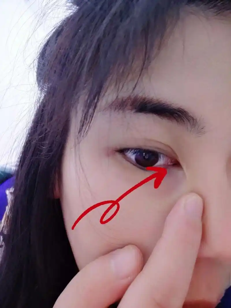 眼角这颗痣什么寓意有人知道么