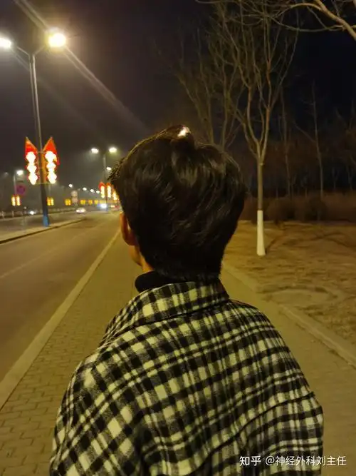 于是——留狼尾最难熬的就是两到三个月的尴尬期,如果没