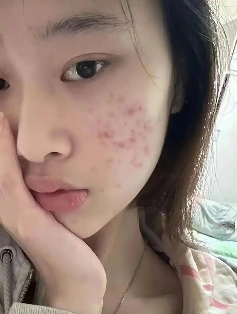 怎么让脸部变得又干净又白 #养出光滑细腻好皮肤 #拯救痘痘 - 抖音