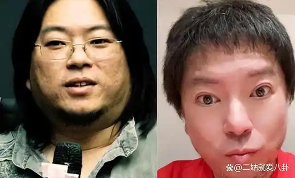 53岁高晓松暴瘦认不出!剪短发瓜子脸似华晨宇,被疑整容想复出