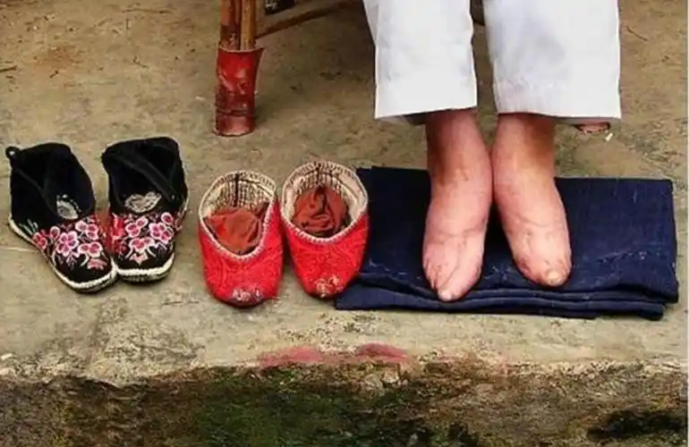 什么时候女人开始裹脚(女人从什么时候开始裹脚)