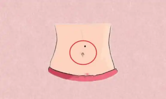 身体6颗"巨富"痣,祖上积德,只要占一颗,少奋斗十年!