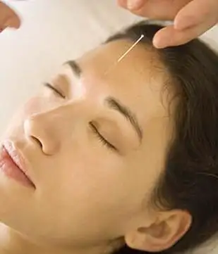 针灸美容培训学校