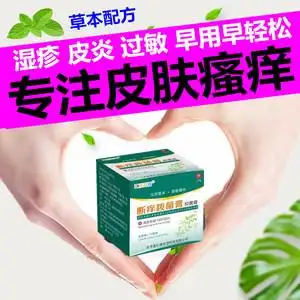 湿疹皮肤专用治疗皮肤瘙痒药膏止痒抑菌起水泡治皮肤痒的药过敏