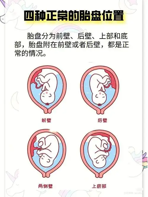 胎盘位置解读