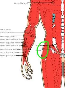 体育课单腿跳损伤了我的右大腿根部侧身肿