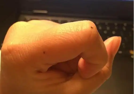 管男生女生,在左右食指的部位都出现痣了,那么这样的情况会导致命运