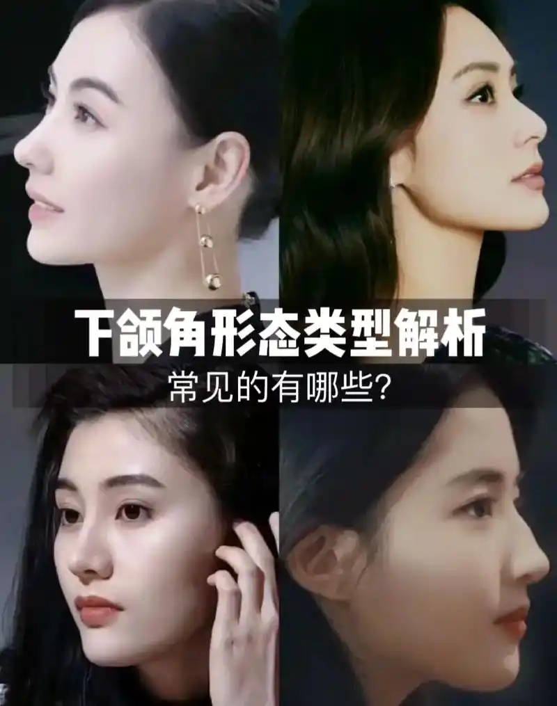分享下颌角形态类型.#颌面轮廓 #美商 #变美 - 抖音