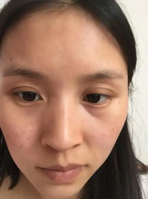 为什么你的肤色暗沉无光,想要美白皮肤就要学会六个技巧