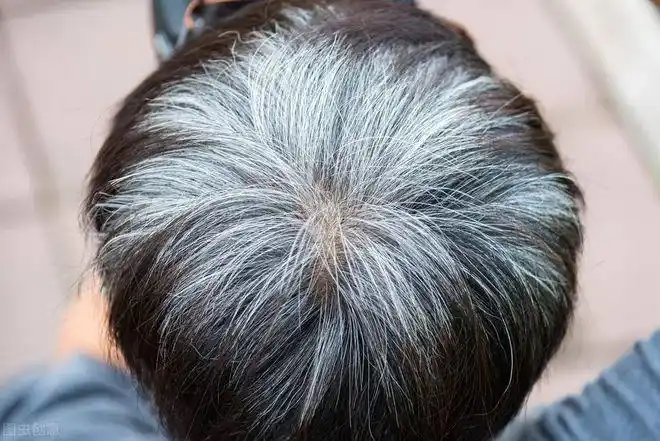 长白头发的人不易患癌长期染发会致癌吗白头发染发好不好