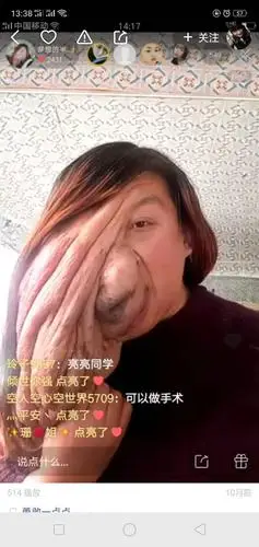 快手上一个脸上张很多肉瘤的女人