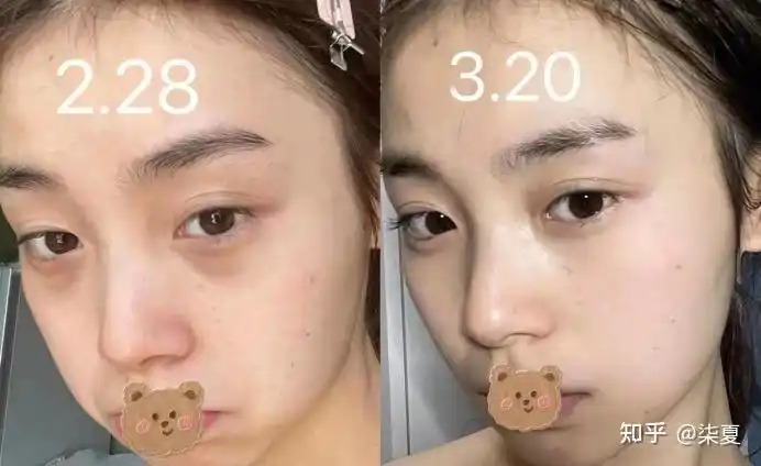 最让你惊为天人的熬夜眼霜是哪个?