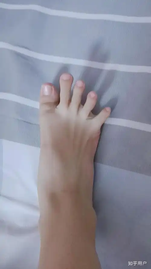 拥有希腊脚的女生真的有更大的可能是美女吗