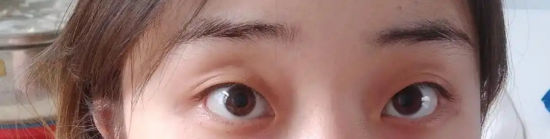 想问一下有没有和我一样上眼皮比较松弛的姐妹呀